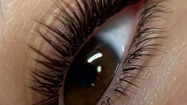 A real upturned eye, the shape this map is drawn for.
